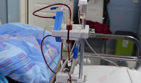 Plasmapheresis for ms treatment procedure