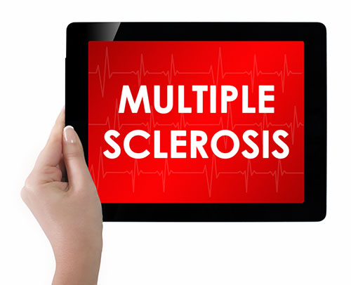 multiple sclerosis risk factors