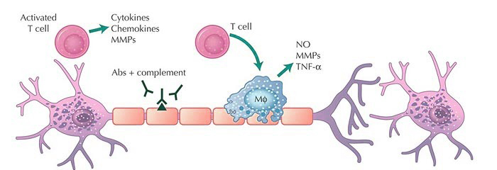 multiple sclerosis treatment remyelination